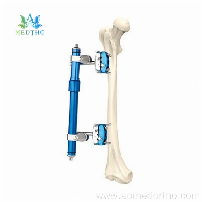 ex fix tibia